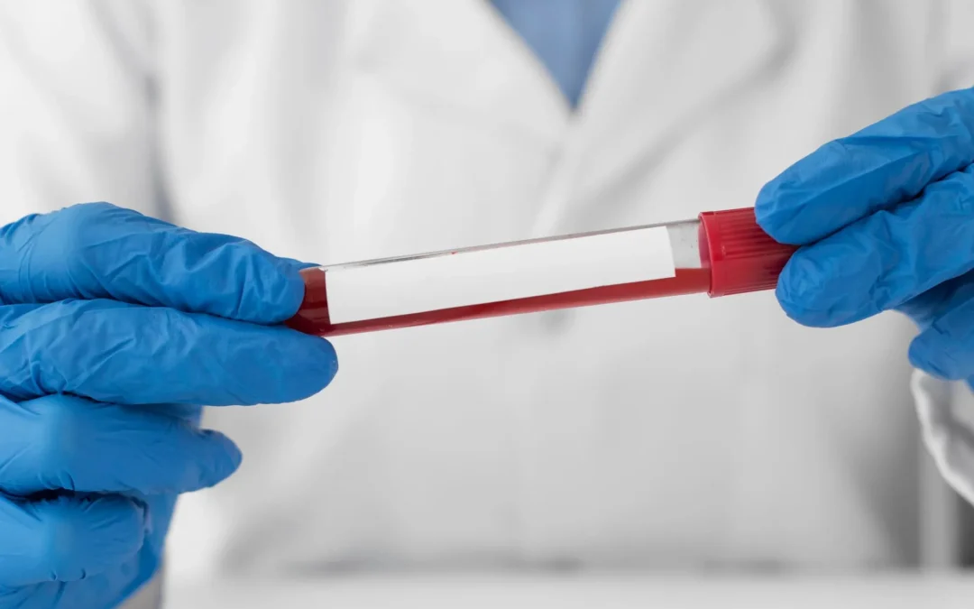 ¿Es fiable un análisis de sangre en verano?