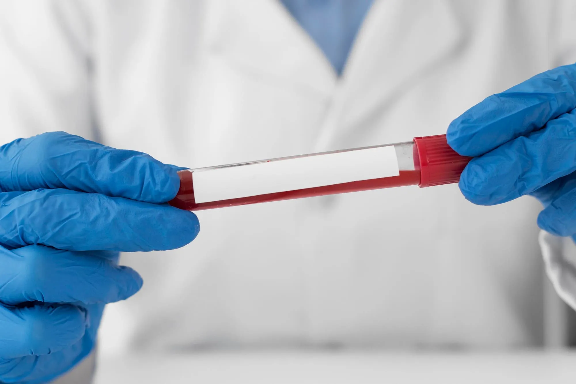 como de fiable es hacerse un analisis de sangre en verano es fiable hacerse un analisis de sangre en verano